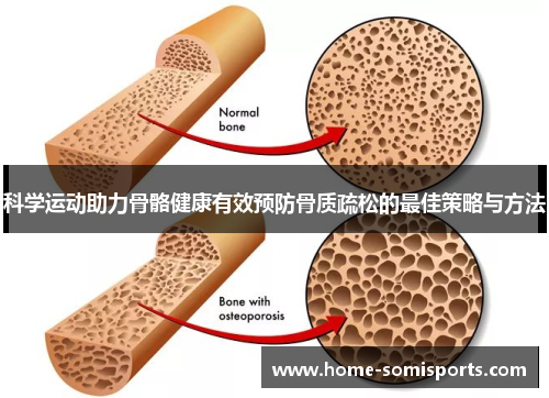 科学运动助力骨骼健康有效预防骨质疏松的最佳策略与方法